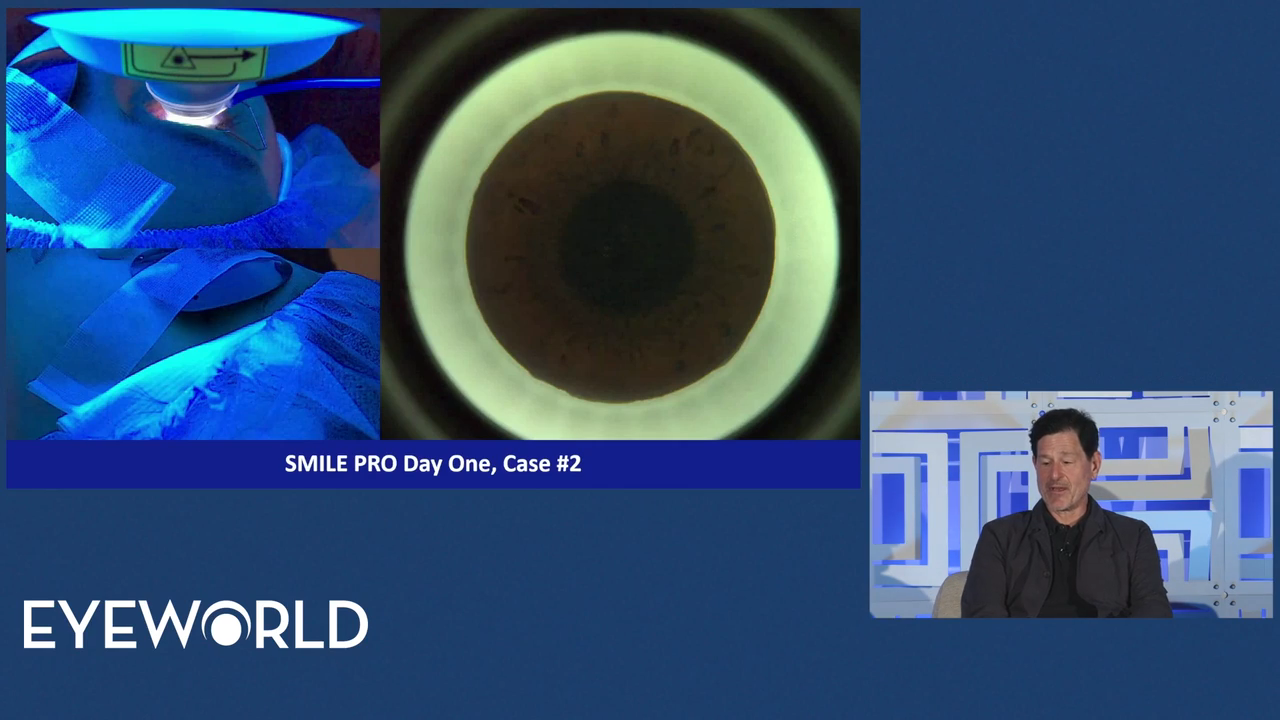 Thumbnail image for Integrating SMILE into Your Practice